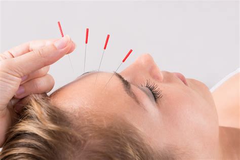 facial acupuncture is a trending lifestyle ask dasha client providers