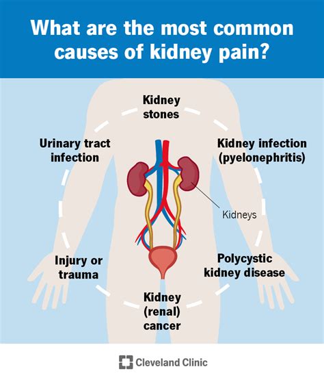 Kidney Pain Causes Treatment And When To Call A Doctor