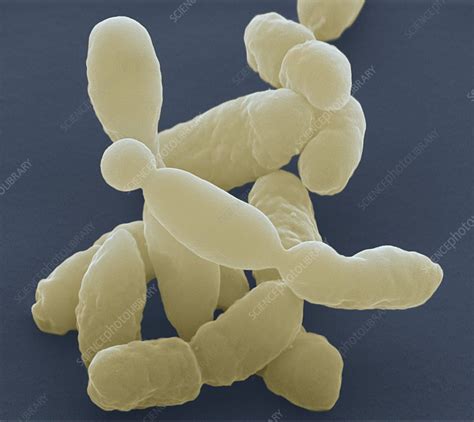 Pasteurella Bacteria SEM Stock Image C Science Photo Library