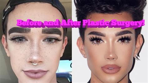 Youtube Beauty Guru Plastic Surgery Before And After Youtube