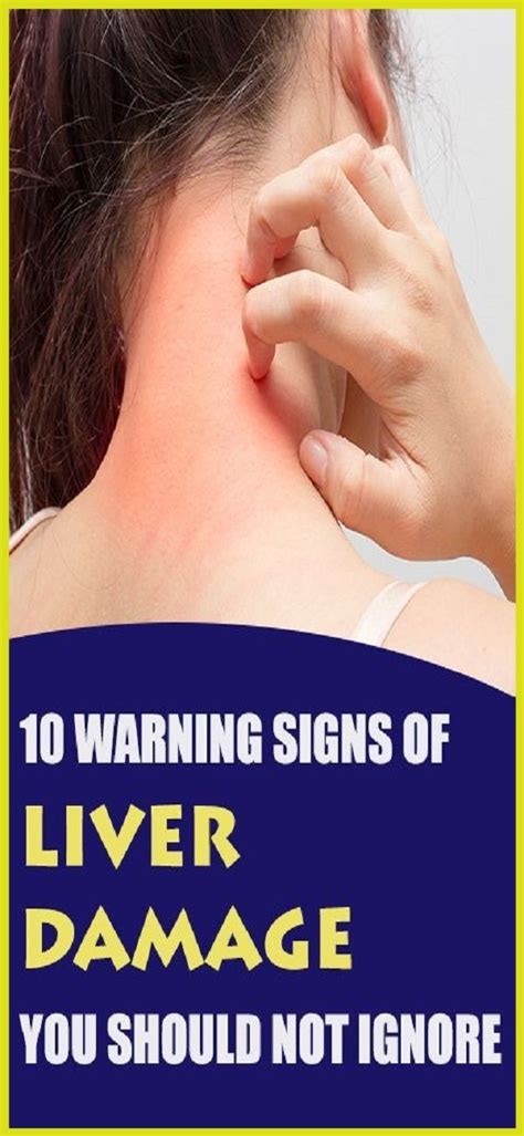 10 Warning Signals Of Liver Damage You Should Not Ignore In 2020