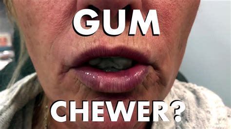 The Unintended Consequences Of Gum Chewing Accelerated Aging Of The