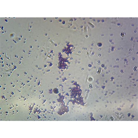 Prepared Microscope Slidediplococci Haemophilus Streptococcus