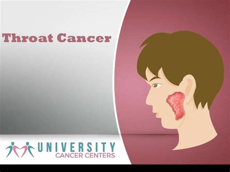 Ppt What Is Throat Cancer And It S Awareness University Cancer