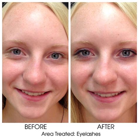 We did not find results for: Eyelash & Eyebrow Tinting | Lebo Skin Care