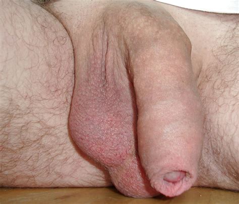 Only Uncut Cock 1 64 Pics Xhamster