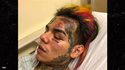 Tekashi69 Hospitalized After Being Kidnapped Pistol Whipped Robbed