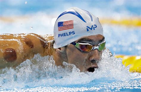 Heres Why Us Swimmer Michael Phelps Has Those Spots On His Body Peninsula Daily News