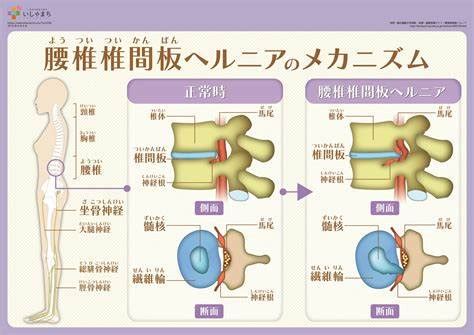 Перевод контекст ありがとうございます c японский на русский от reverso context: SOS 腰が痛い〜 この際 原因と対処方法を徹底解明してみた - Life ...