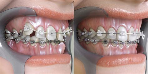 what is orthodontics dentist on victoria