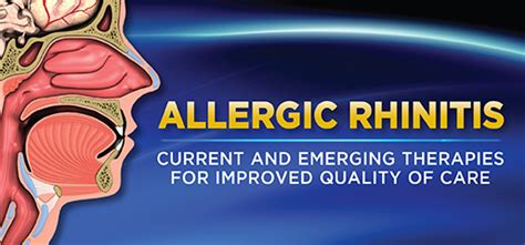 Nonallergic Rhinitis