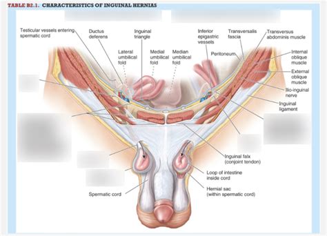 Inguinal Hernia Surgery Anatomy My XXX Hot Girl