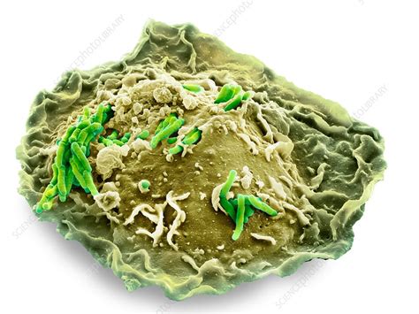 Macrophage Engulfing Tb Bacteria Sem Stock Image C0140591