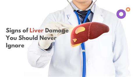 Signs Of Liver Damage You Shouldnt Ignore Firstcure Health