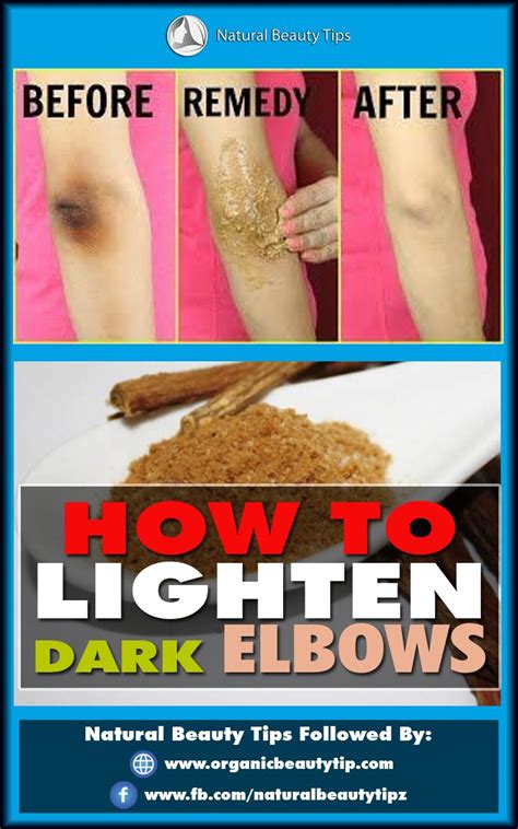 How To Lighten Dark Elbows Natural Beauty Tips Dark Elbows Lightening