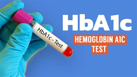 Hemoglobin A1c Test Is Important Youtube