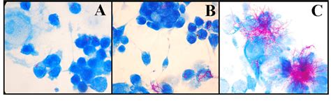 Figure 1 From Construction Of A Nocardia Brasiliensis Fluorescent