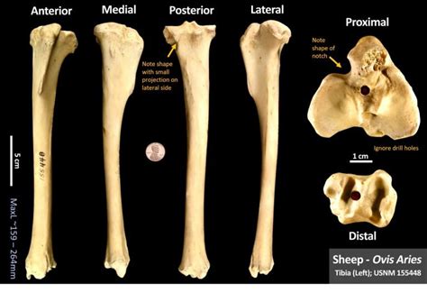 Sheep Tibia Osteoid Bone Identification