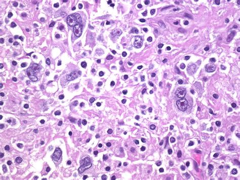 A Collection Of Surgical Pathology Images