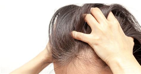 Sakit kepala sering berlaku kepada mereka yang mencecah belasan tahun sehinggalah dewasa. Kulit Kepala Gatal: Punca, Simptom dan Rawatan - The Diagnosa
