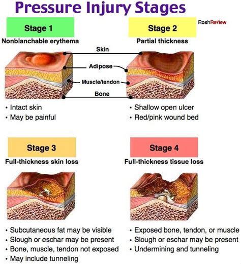 Pressure Injury Stages Wound Care Nursing Pressure Ulcer Staging