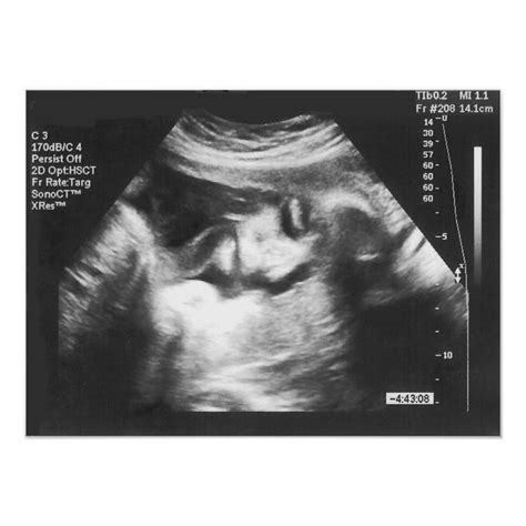 prank fake ultrasound picture poster zazzle fake ultrasound ultrasound pictures ultrasound