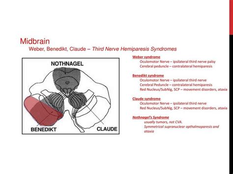Midbrain Syndromes Nerve Palsy Syndrome Disorders