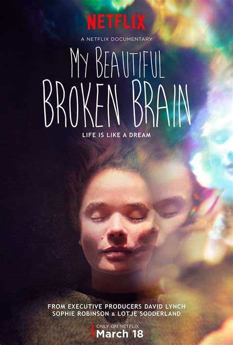 My Beautiful Broken Brain Reveals The Aftermath Of A Brain Hemorrhage