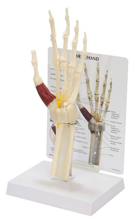 Anatomy Model Hand Rheumatoid Arthritis