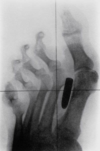 Real X Rays That Will Shock You 22 Pics Izispicy Com