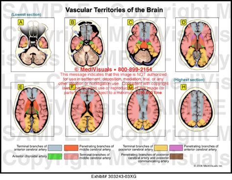 Vascular Territories Of The Brain Medical Illustration Medivisuals