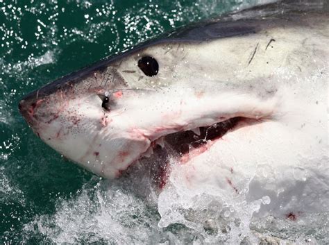 Australia Shark Attack Victim Reveals Gruesome Leg Injuries After Being