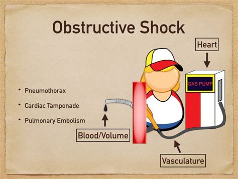 Types Of Shock Cardiogenic Vs Hypovolemic Vs Obstructive Vs Hot Sex