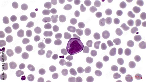 A Smear Of Human Blood Under A Microscope In The Center Among