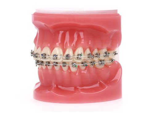 The Art® Spring American Orthodontics