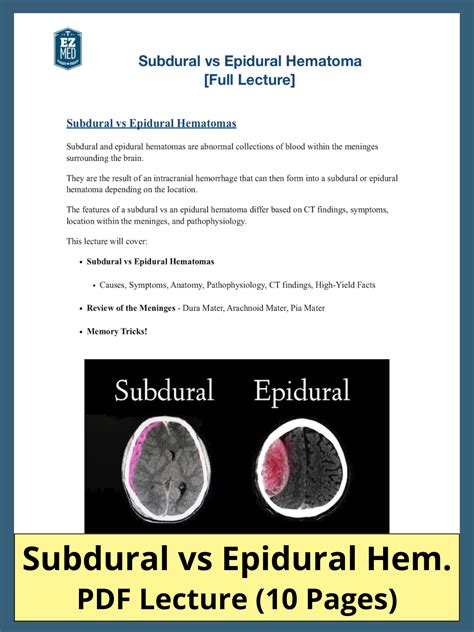 Subdural Vs Epidural Hematoma Ct Findings Location Symptoms And