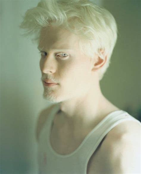 Les top modèles albinos qui brisent les tabous TPL Stephen thompson
