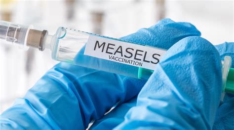 Measles Outbreak Another 90 Cases Reported For Biggest Jump This Year