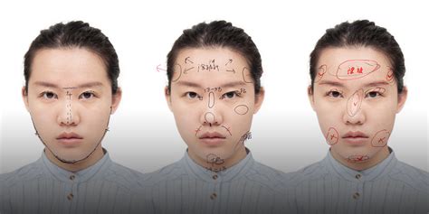 the true face of china s plastic surgery clinics