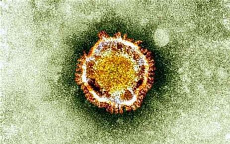 Jun 18, 2021 · the lambda variant has been detected by scientists in the region, including in chile, peru, ecuador and argentina, thanks to increased genomic surveillance. What we know about the Delta variant in SA so far