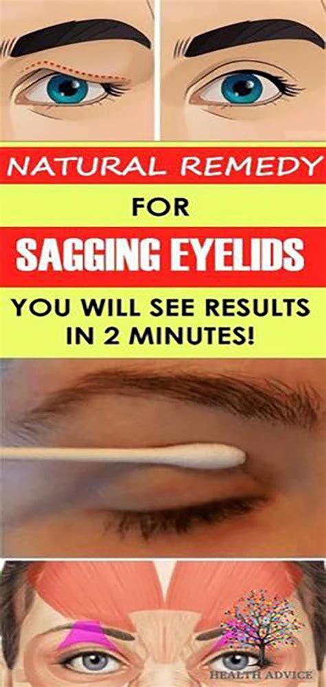 Natural Remedy For Sagging Eyelids You Will See Results In 2 Minutes