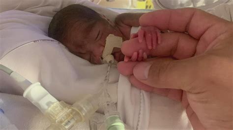 Tiny Miracle Baby Born 18 Weeks Early Is Home For The Holidays Youtube