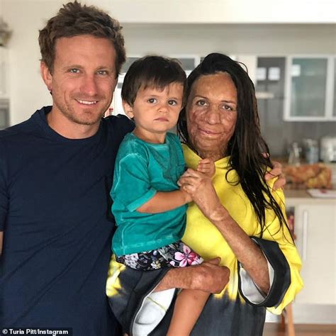 Inspirational burns survivor Turia Pitt welcomes her second child with fiancé Michael Hoskin