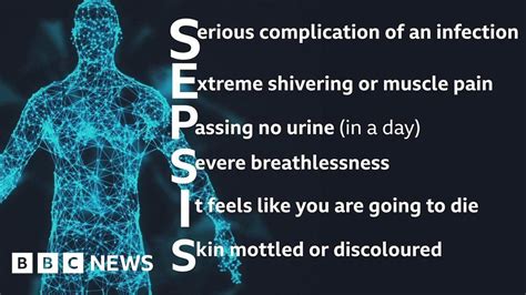 Sepsis What Is It And How To Spot It Bbc News