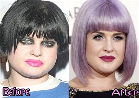 Check out my new podcast the kelly osbourne and jeff beacher show!!! Kelly Osbourne Plastic Surgery Before After Photos | Celebrities Plastic Surgery | PSID