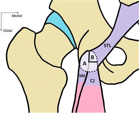 Schematic Diagram Of The Hamstring Tendon Attachment Of The Ischial
