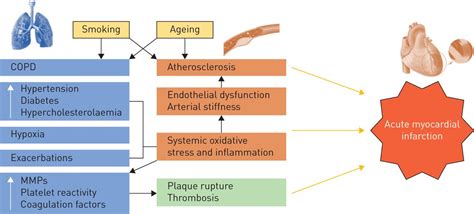 Diagram Pathophysiology Of Myocardial Infarction Ppt Interleukin 1