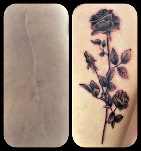 Hip Replacement Scar Tattoo Tattoosai