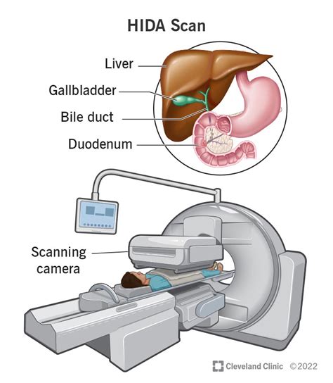Hida Scan What It Is Purpose Procedure And Results