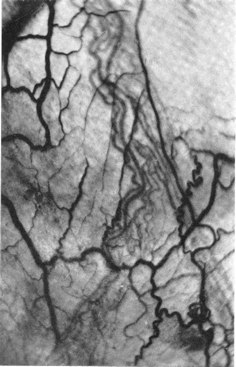 Structure Of External Spermatic Fascia Semantic Scholar